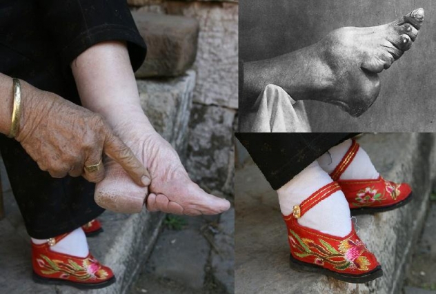 Foot-binding